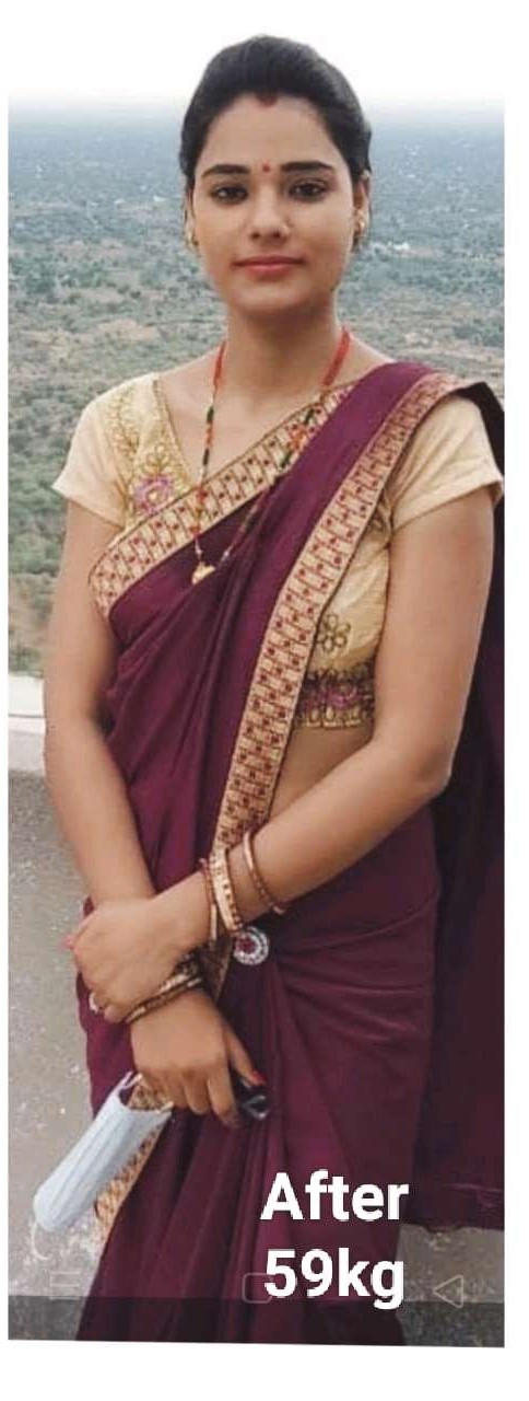 Pinky Devi Transformation After